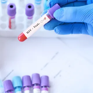 性感染症・HIVの診療